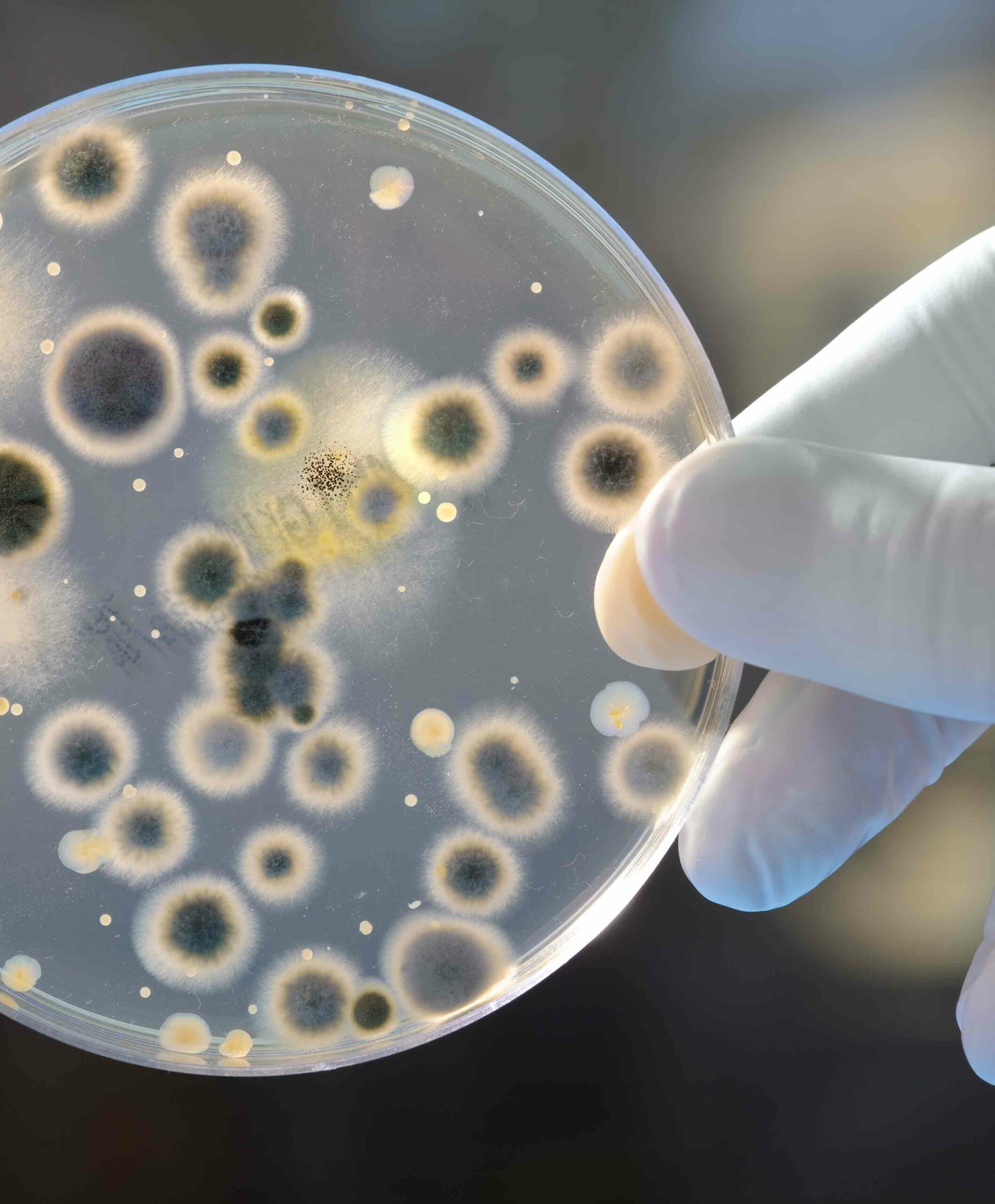 Microbiologicos Maestría Internacional en Ensayos Microbiológicos | Esneca Medical