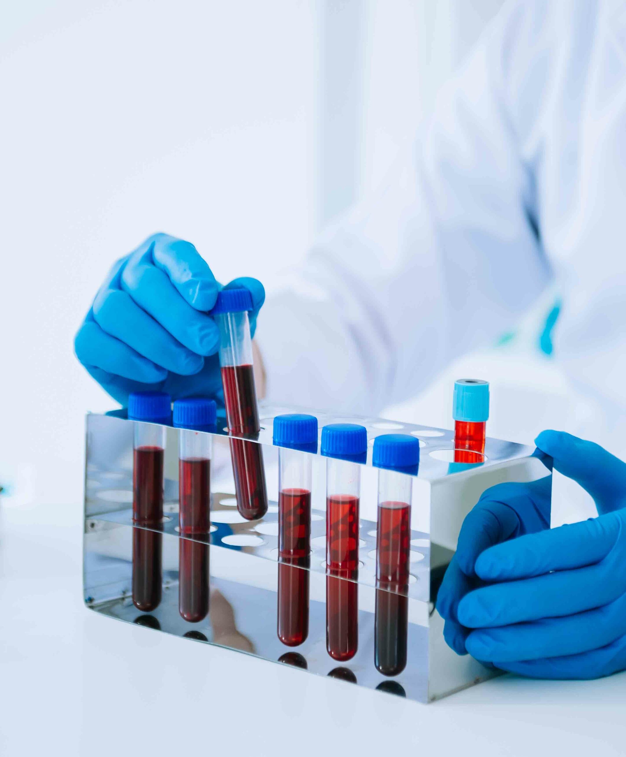 Maestría Internacional en Laboratorio Clínico + Maestría Internacional en Fases Preanalítica y Postanalítica Clínicas – Diploma Acreditado por Apostilla de la Haya