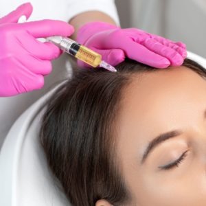 Estudia la Maestría Internacional en Mesoterapia Capilar