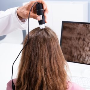 Estética Capilar y en Microinjertos Capilares
